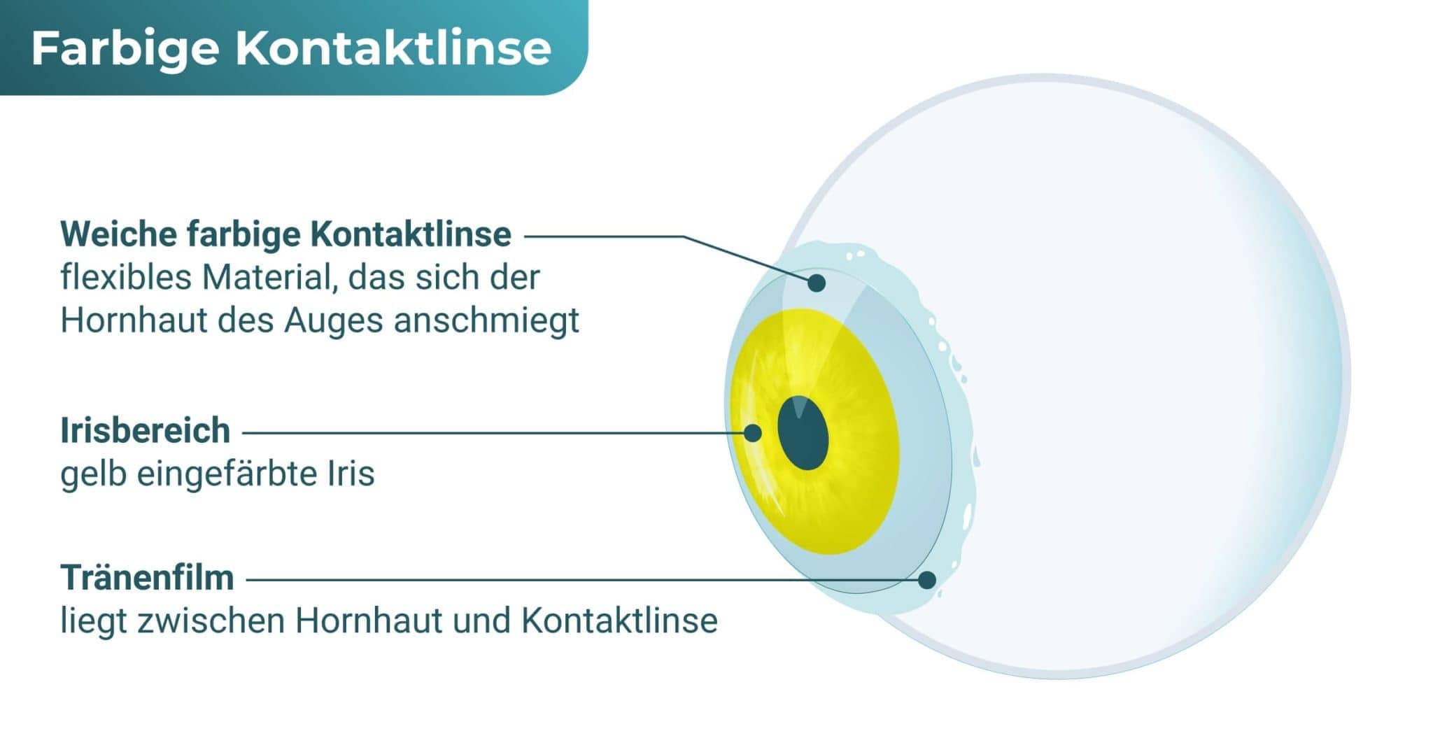 Farbige Kontaktlinsen (FunLinsen) Alles Wissenswerte