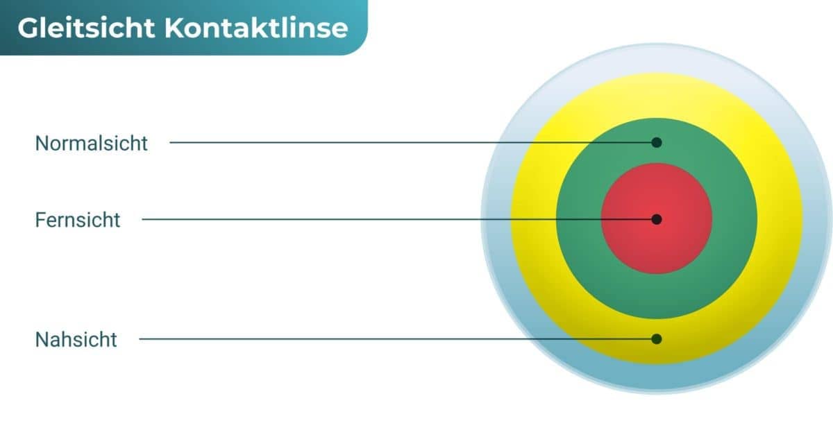 Multifokale Kontaktlinsen (Gleitsicht Kontaktlinsen)