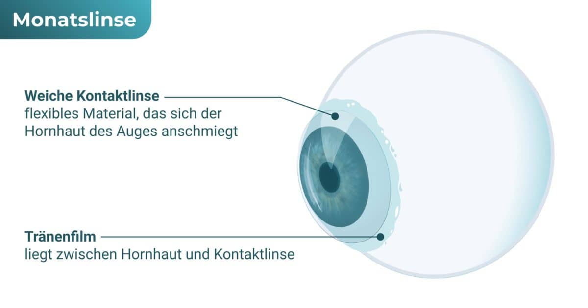 Weiche Monatslinsen