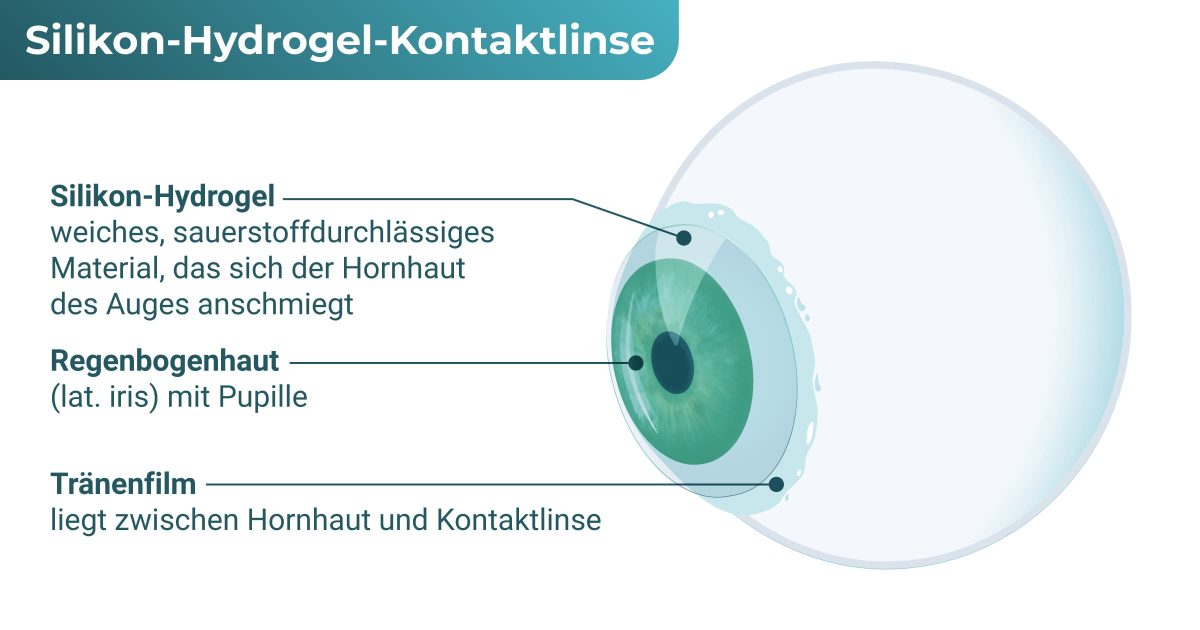 Silikon-Hydrogel-Kontaktlinse