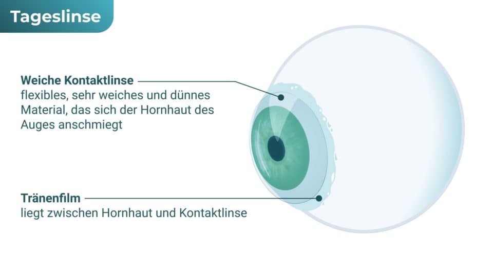 Tageslinse / Tageskontaktlinse