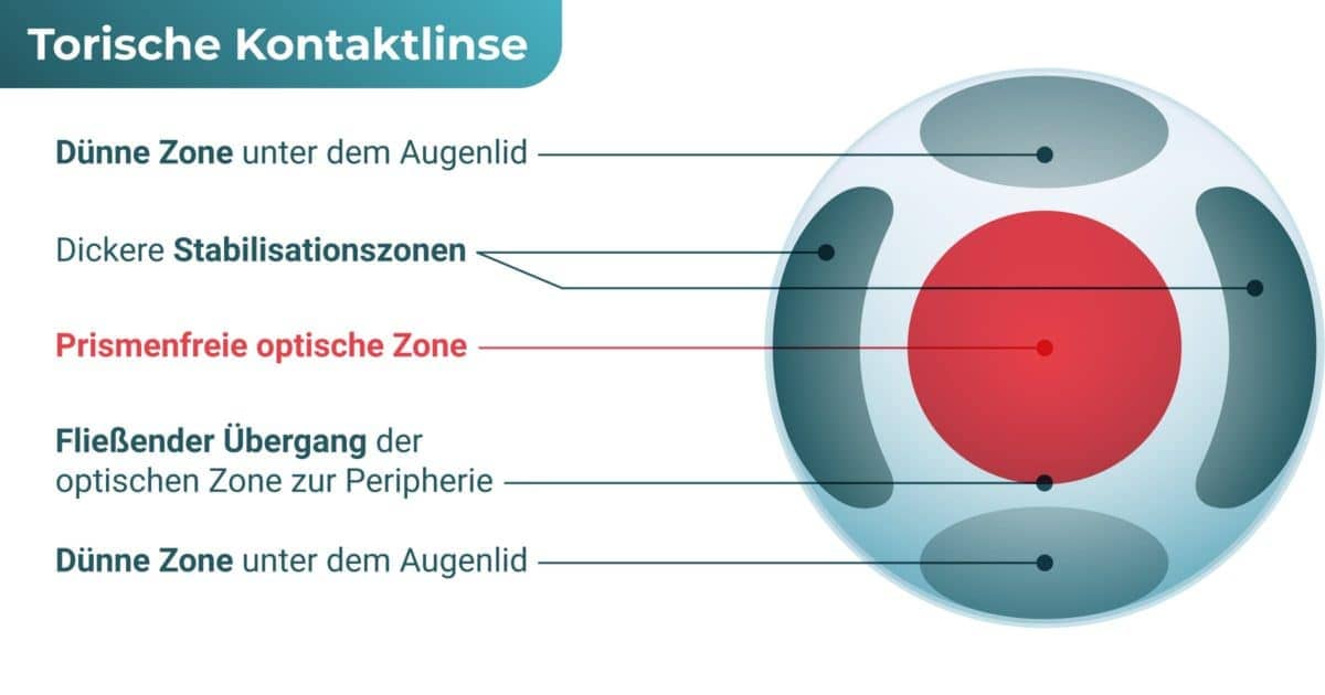 Gleitsicht kontaktlinsen erfahrungen