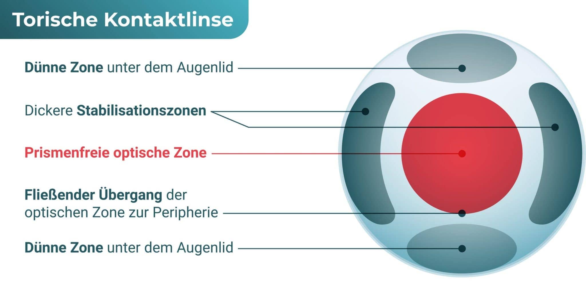 Torische Kontaktlinsen Alles Wissenswerte